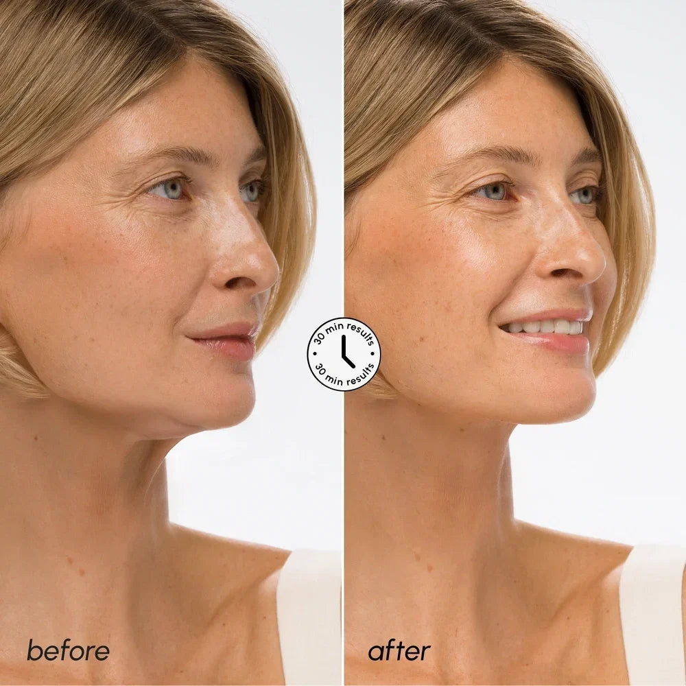 Hyaluronic Acid V-line Lifting Mask 10 PCS