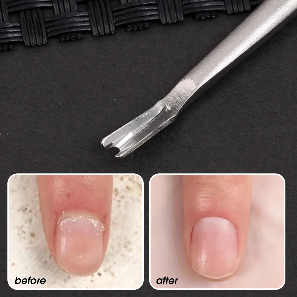5PCS Cuticle Pusher Professional Stainless Steel Nail Cuticle Trimmer Remover Callus Dead Skin Fork Nail Manicure Pedicure Tool